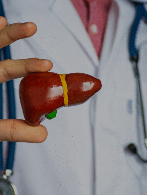 fatty liver